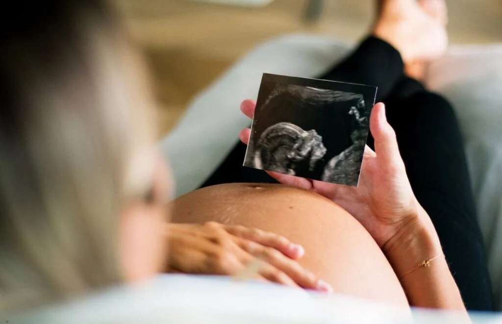 Vascular para gestantes